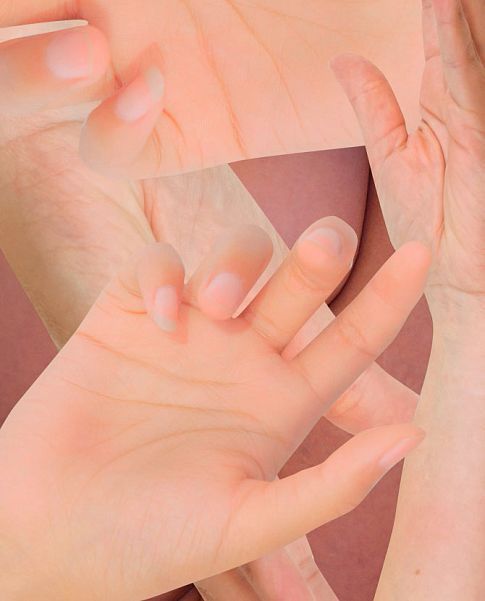 Аллергия на укусы насекомых: куда бежать и что делать